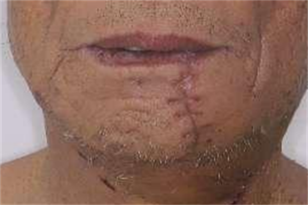 640 (4).png 640 (4).png