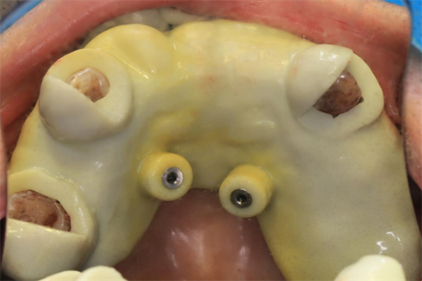 640 (2).png 640 (2).png