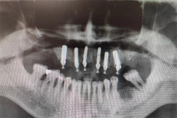 640 (3).png 640 (3).png