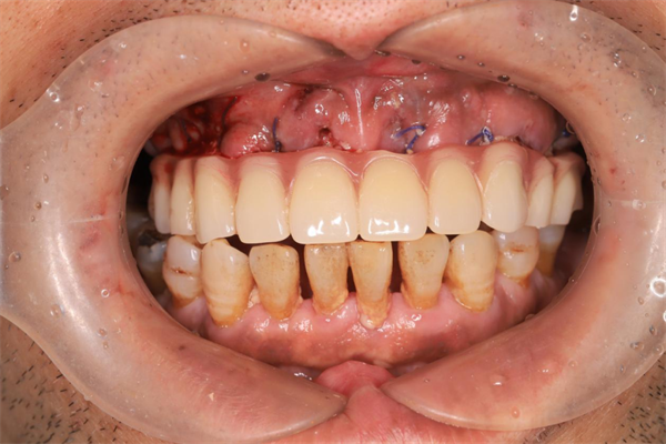 640 (4).png 640 (4).png