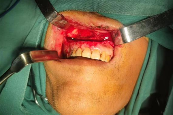 圖片2.png 圖片2.png