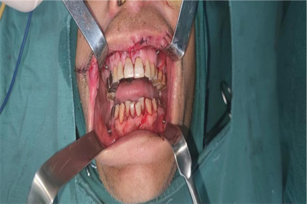 圖片1.png 圖片1.png