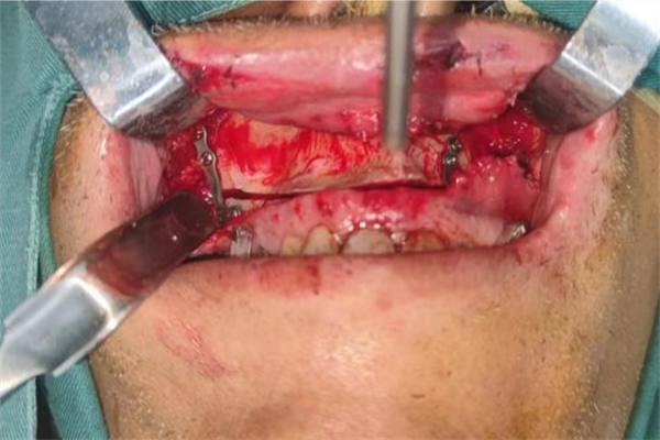 圖片3.png 圖片3.png