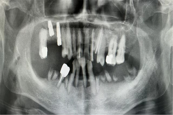 640 (1).png 640 (1).png